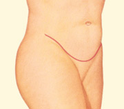 After Image