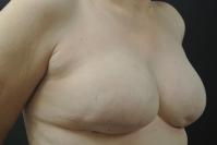 After Image