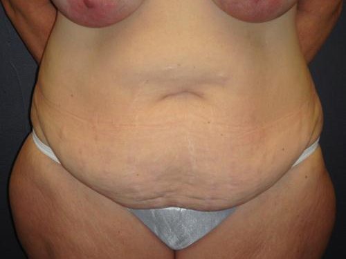 Before Image