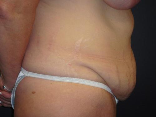 Before Image